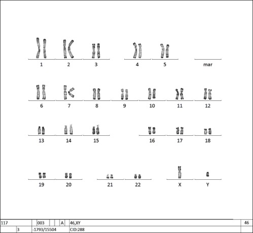 INSRMi002-A · Cell Line · hPSCreg