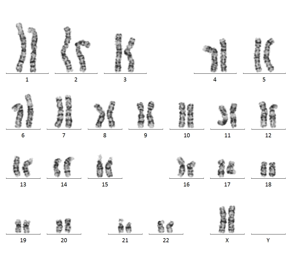 CIRAi005-A-1 · Cell Line · hPSCreg