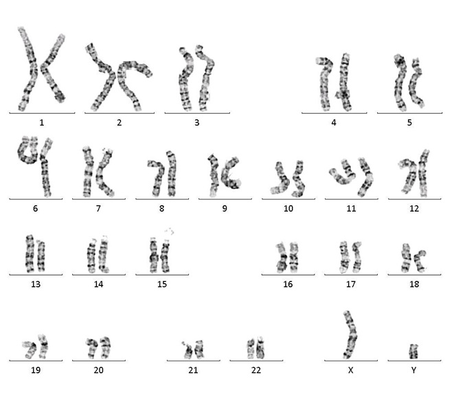 BIONi010-C-2 · Cell Line · hPSCreg