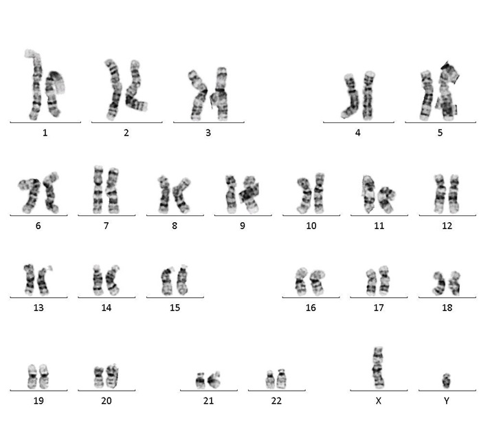 BIONi010-C-7 · Cell Line · hPSCreg