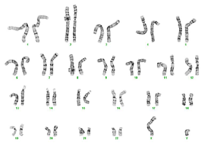 CRMi001-A · Cell Line · hPSCreg