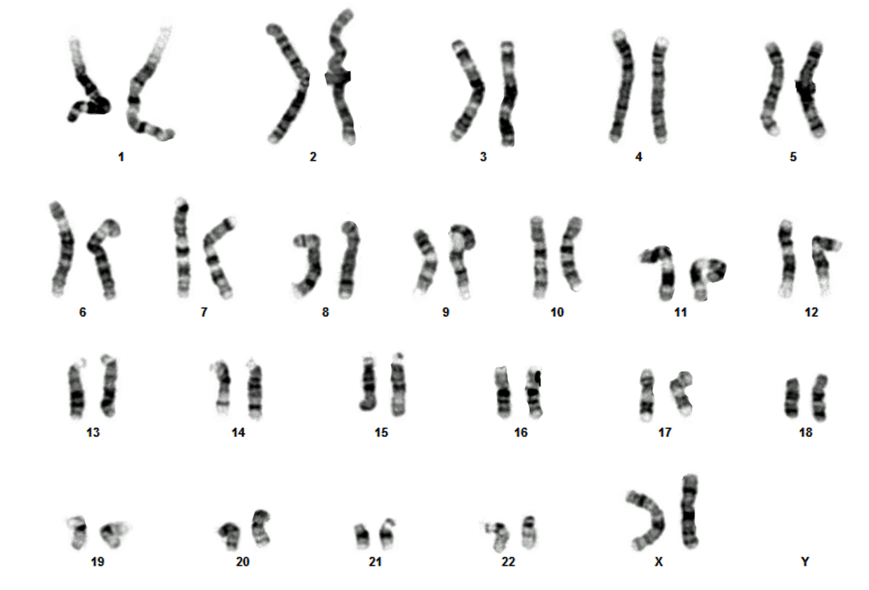 IOBi001-A · Cell Line · hPSCreg